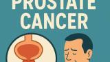 Prostate cancer - What you need to know